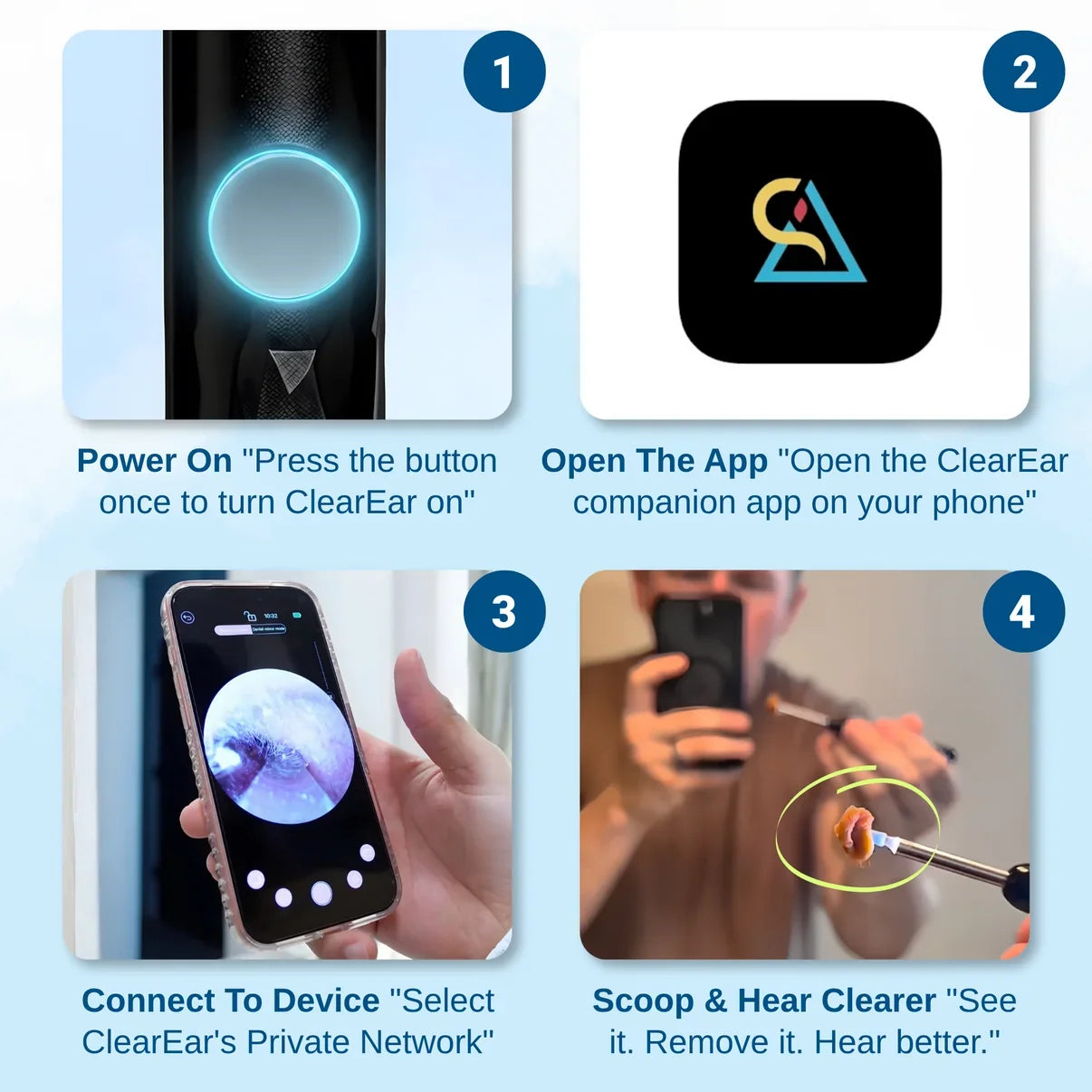 Orion™ Earwax Removal Kit